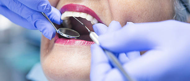 Best Emergency Root Canal Treatment in Lindenhurst, IL