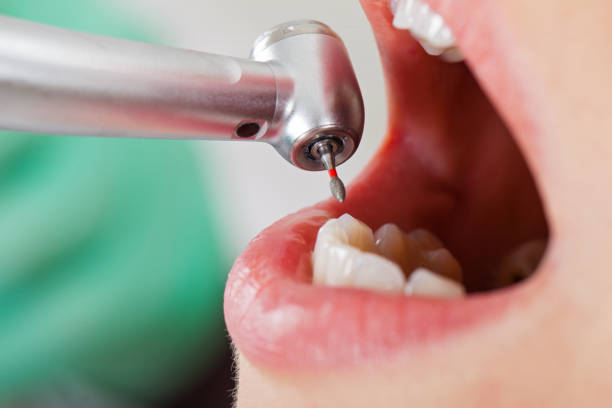 Best Emergency Dentist for Knocked-Out Tooth in Lindenhurst, IL